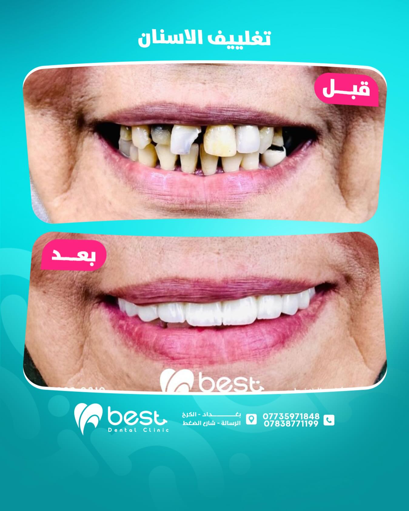 حالة علاجية