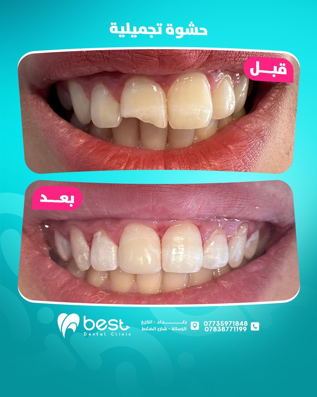 حالة علاجية