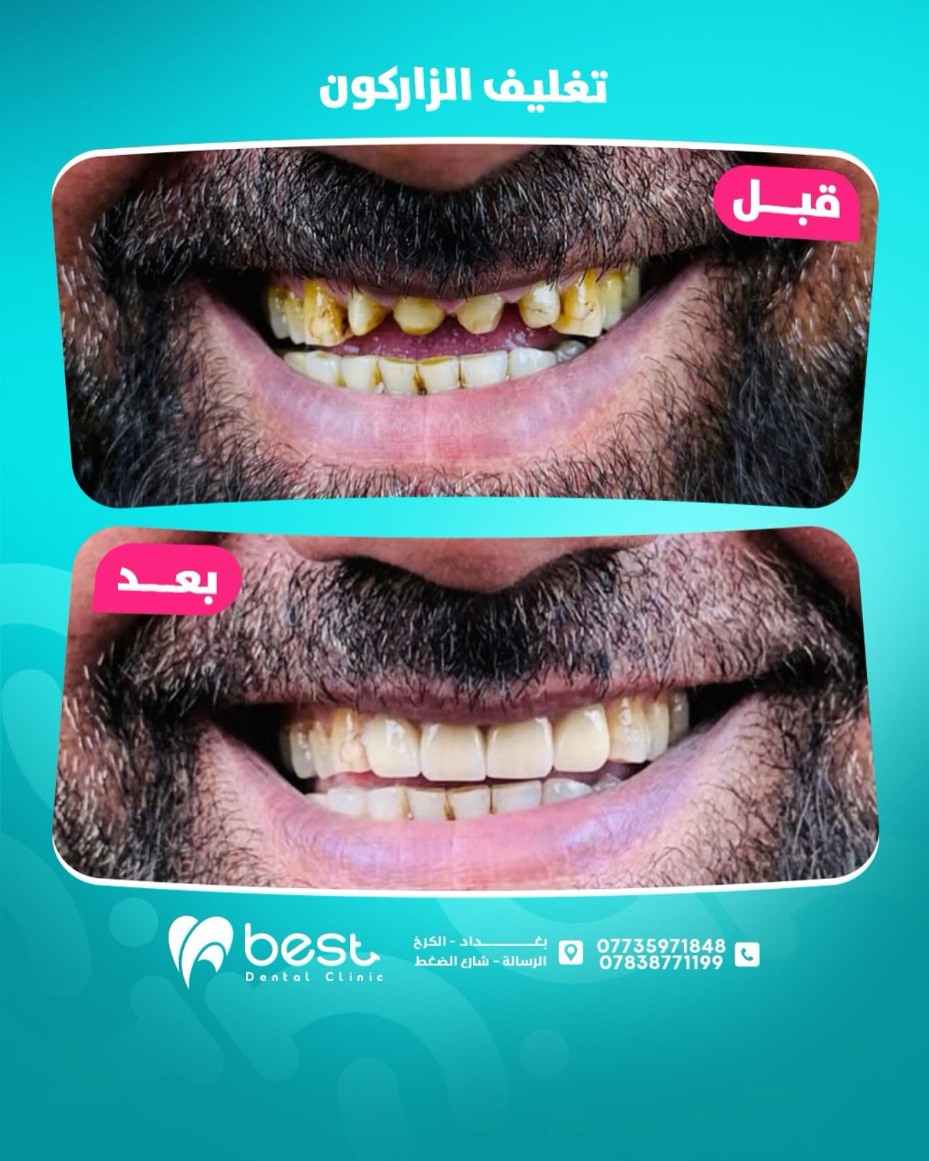 حالة علاجية