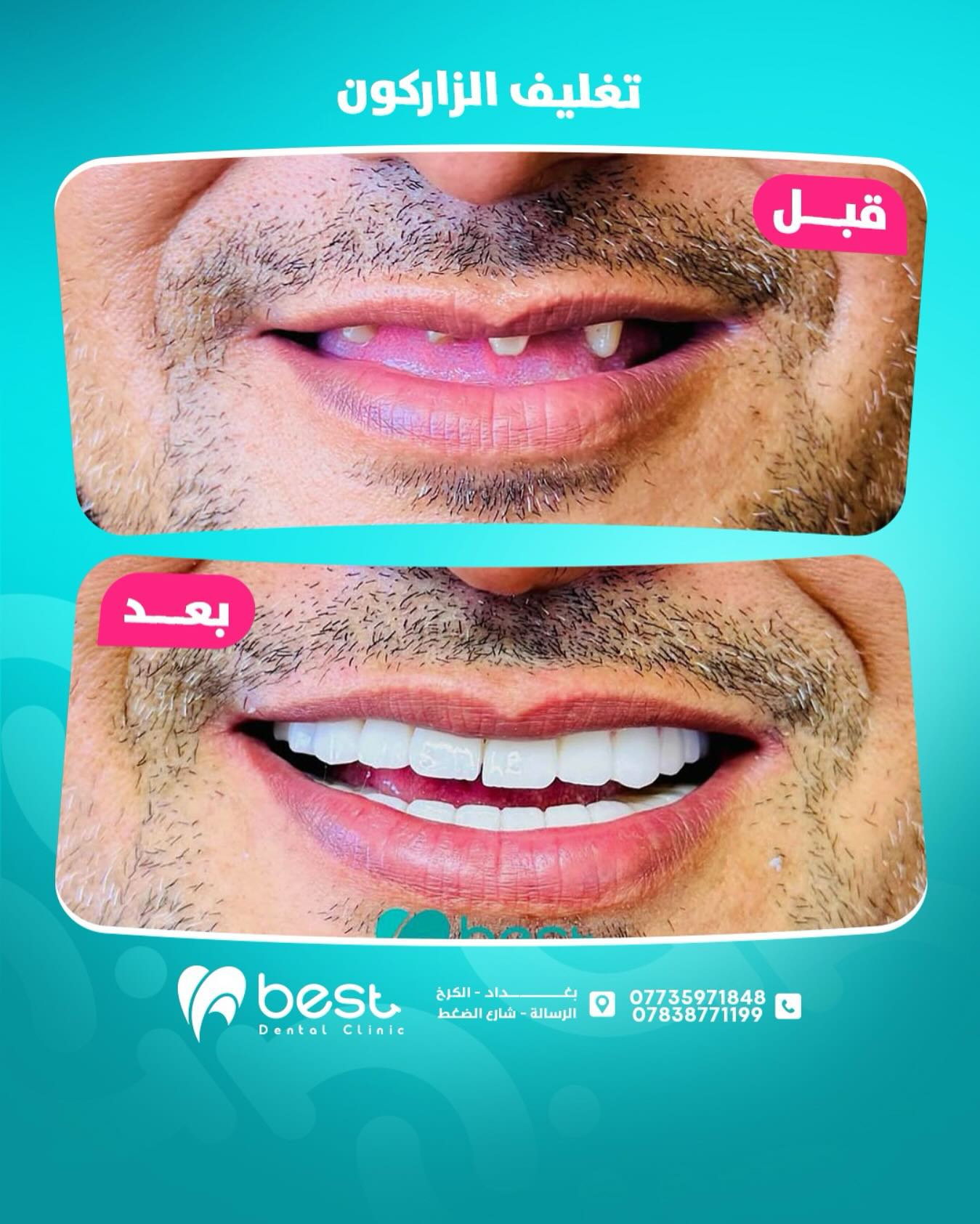 حالة علاجية